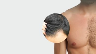 Body hair loss -Top Natural Solutions for Treating Body Hair Loss