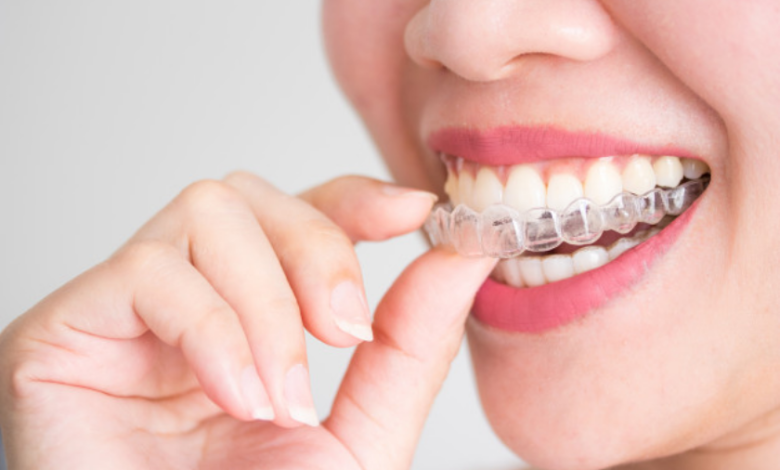 Invisalign doctor site