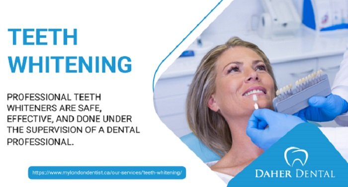 teeth whitening London Ontario