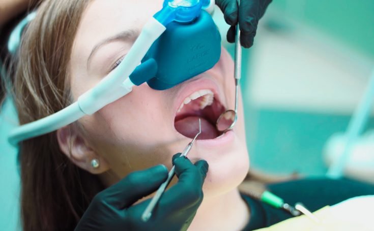 nitrous oxide sedation in dentistry